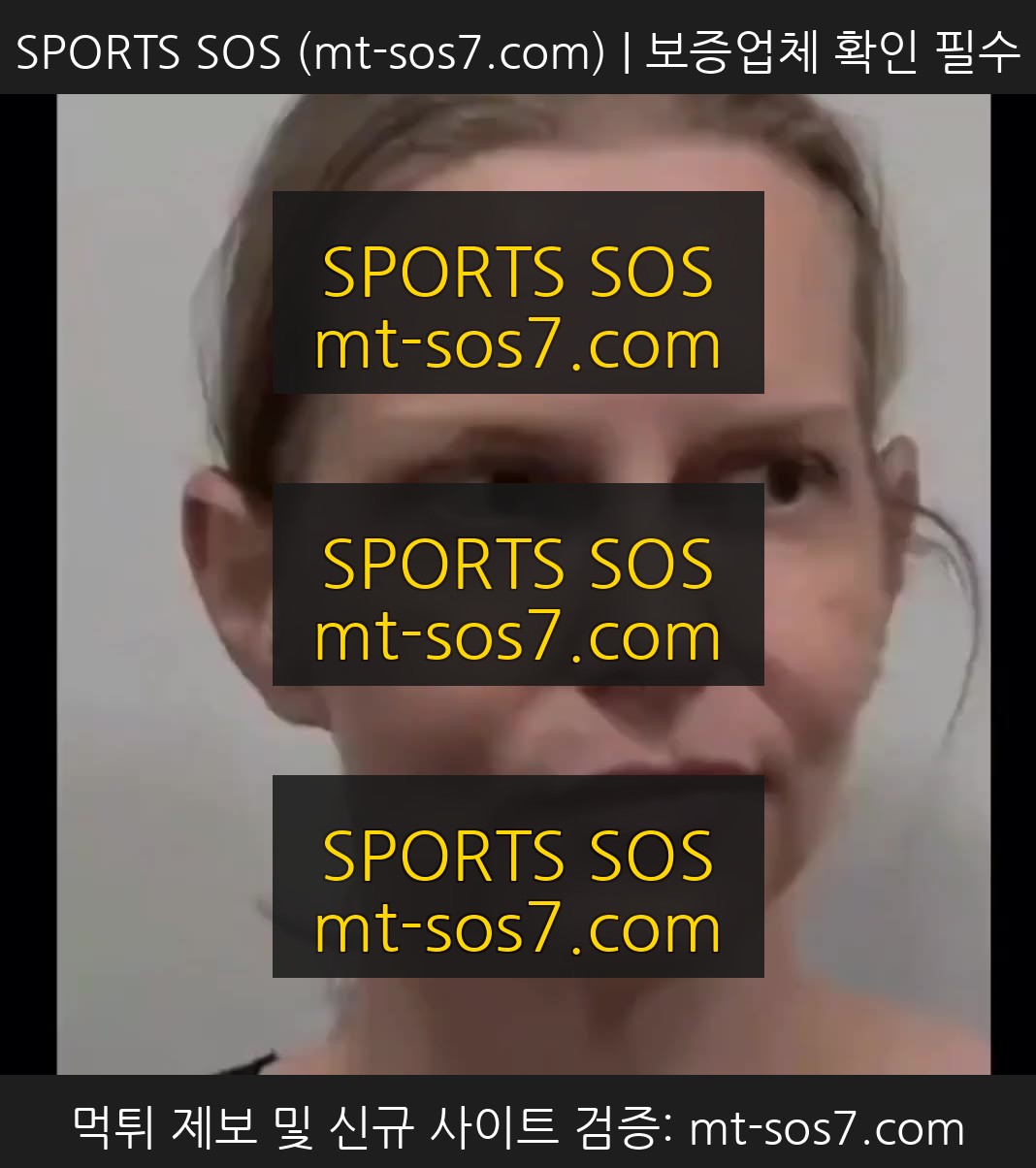 SPORTS SOS | 한국에서 젊어지는 성형수술한 서양 여성 수술 전후 확인 필수