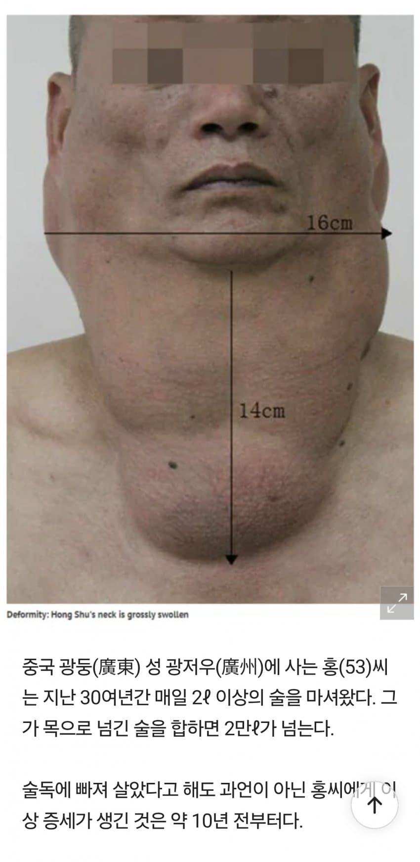 SPORTS SOS | (약혐) 술을 물처럼 마시면 생기는 일
