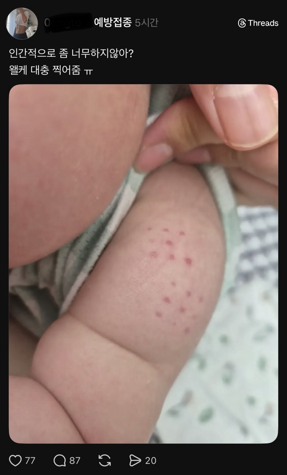 SPORTS SOS | 거진 평생 가는 주사자국인데 너무 한 거 같음.. 정보