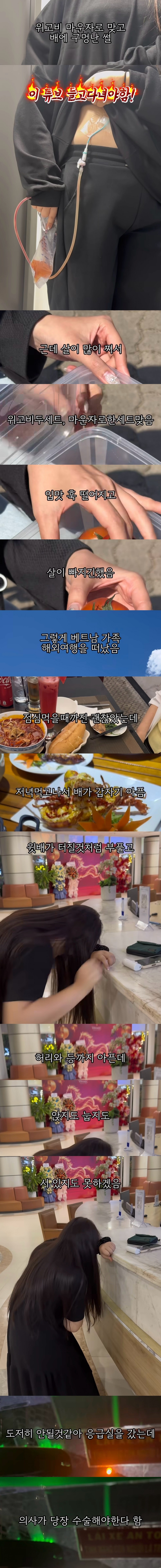 SPORTS SOS | 위고비 마운자로 맞고 배에 구멍난 썰 정보