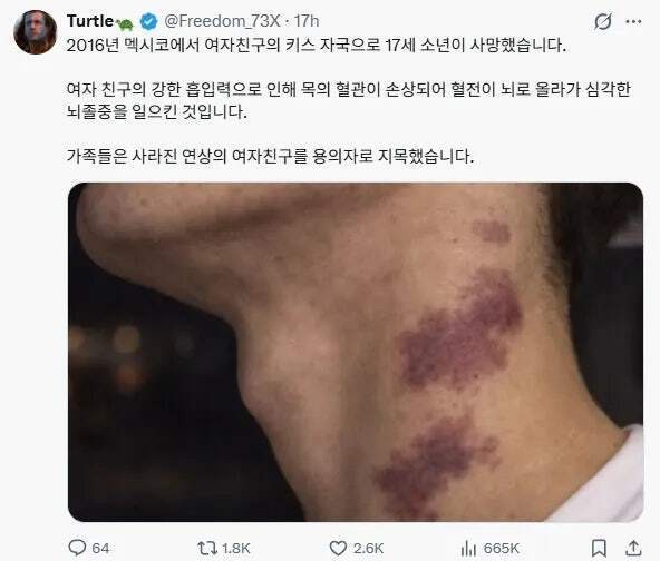 SPORTS SOS | 목에다 키스하면 안되는 이유 [속보]